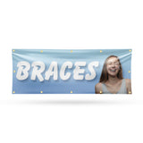 Braces Banner