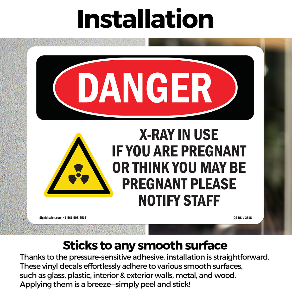 X-Ray In Use If You Are Pregnant