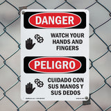 Watch Your Hands And Fingers