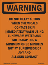 Do Not Delay Action When Chemicals Contact